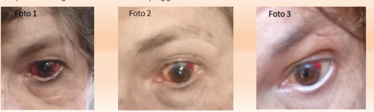 Client-supplied eye images