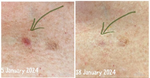 Client-supplied skin images